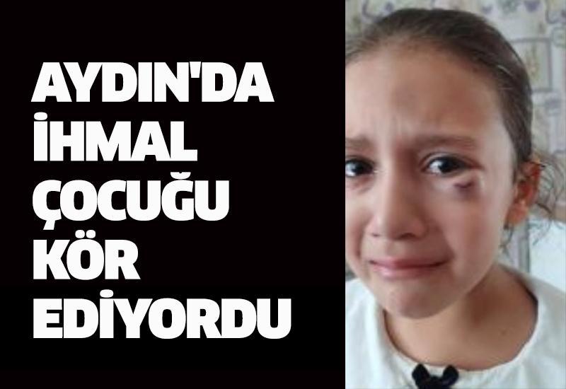 Aydın'da ihmal çocuğu kör ediyordu
