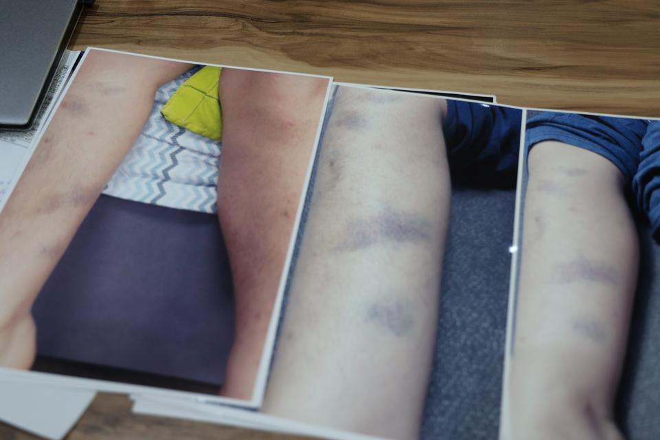 Özel okulda darp iddiası