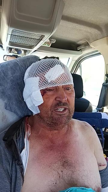 Aslanın saldırısına uğrayan çiftçi konuştu