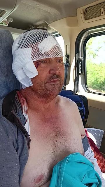 ASLANIN SALDIRISINA UĞRAYAN ÇİFTÇİ O ANLARI ANLATTI: "BİRAZ GÜÇLÜ OLMASAYDIM, ŞU ANDA BENDE BELKİ DE YOKTUM"